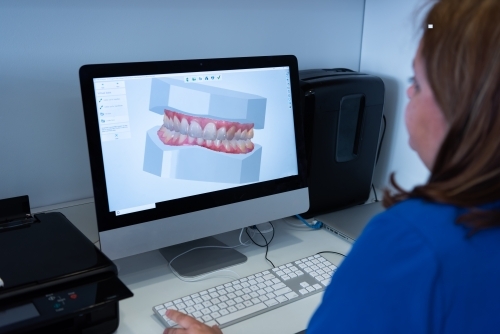 Digital intraoral scanner view of teeth on a monitor