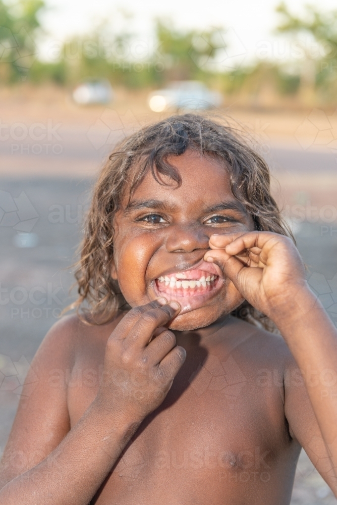 Aboriginal boy showing his missing teeth - Australian Stock Image