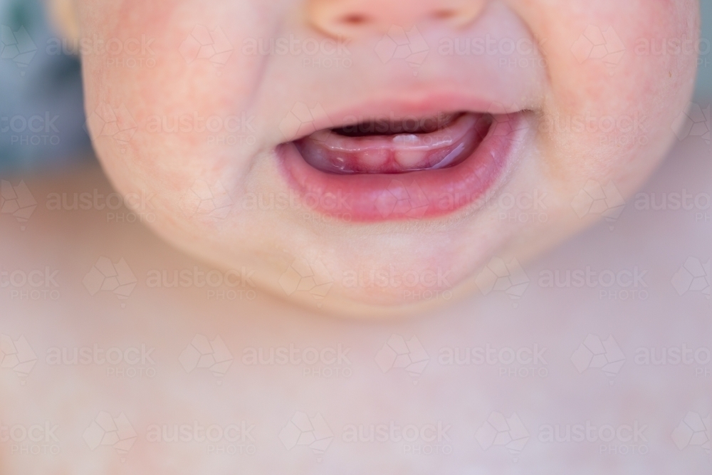 Image of Baby with mouth open and first tooth just broken through