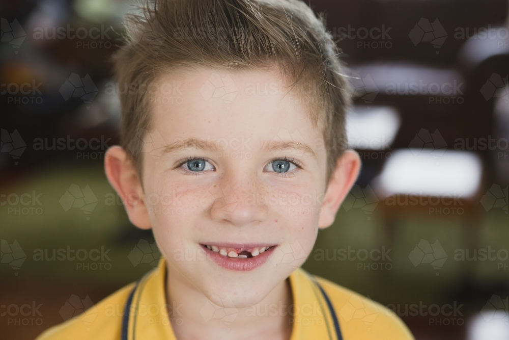 Boy with missing tooth smiling - Australian Stock Image