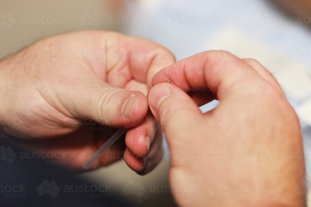 Close up of hands holding acupuncture needles - Australian Stock Image