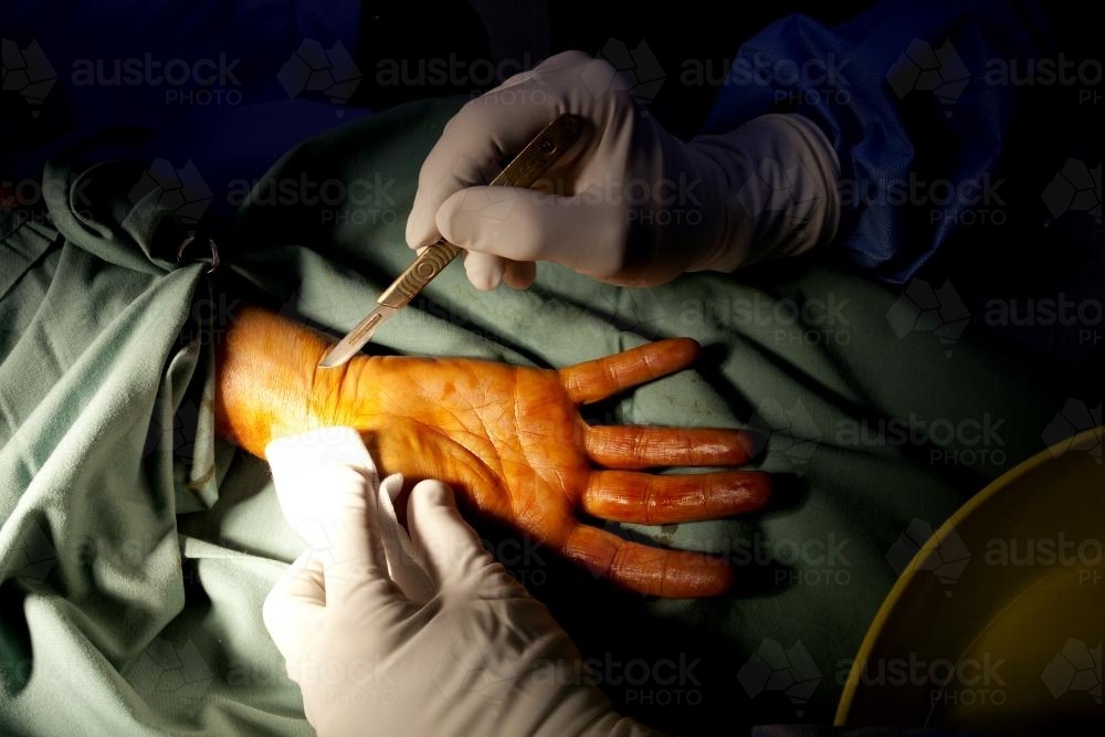 Detail of a surgeon performing surgery in a hospital operating theatre - Australian Stock Image