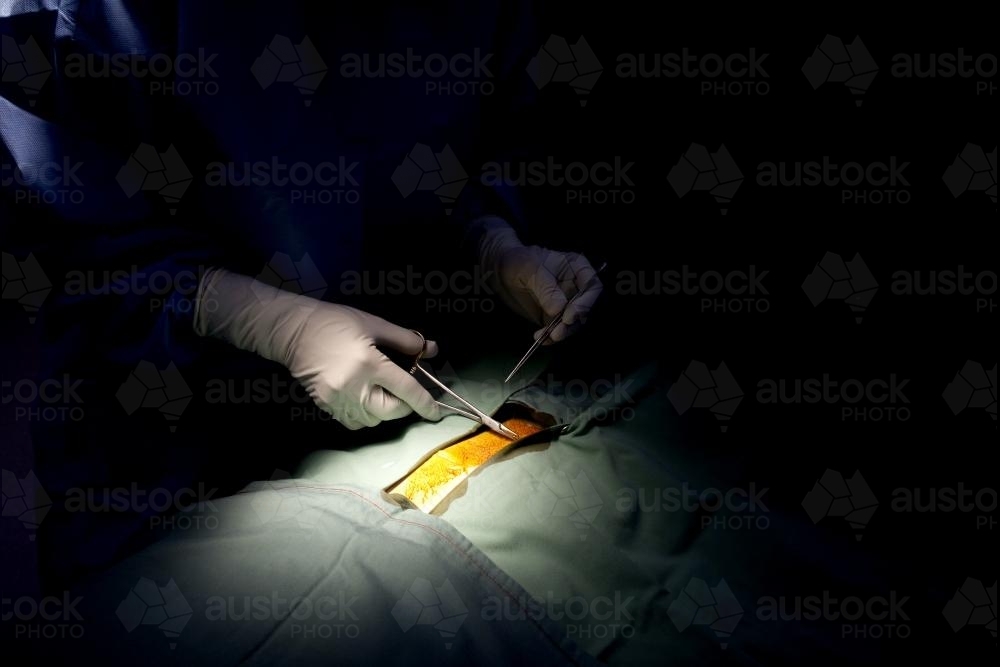Detail of a surgeon performing surgery in a hospital operating theatre - Australian Stock Image