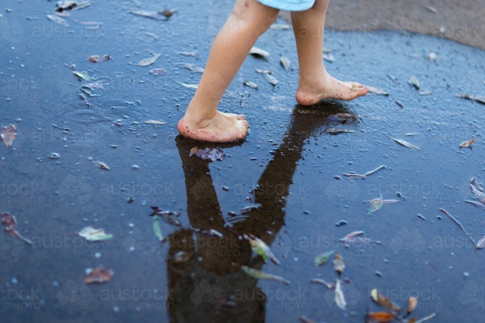 feet of child with club foot walking on wet pavement - Australian Stock Image