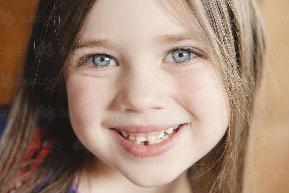 Little girl first lost tooth - Australian Stock Image