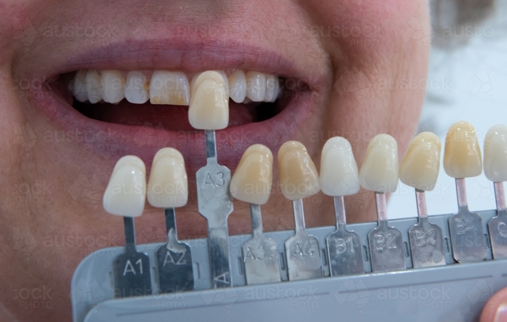 Image of Matching teeth colour with tooth shade guide - Austockphoto