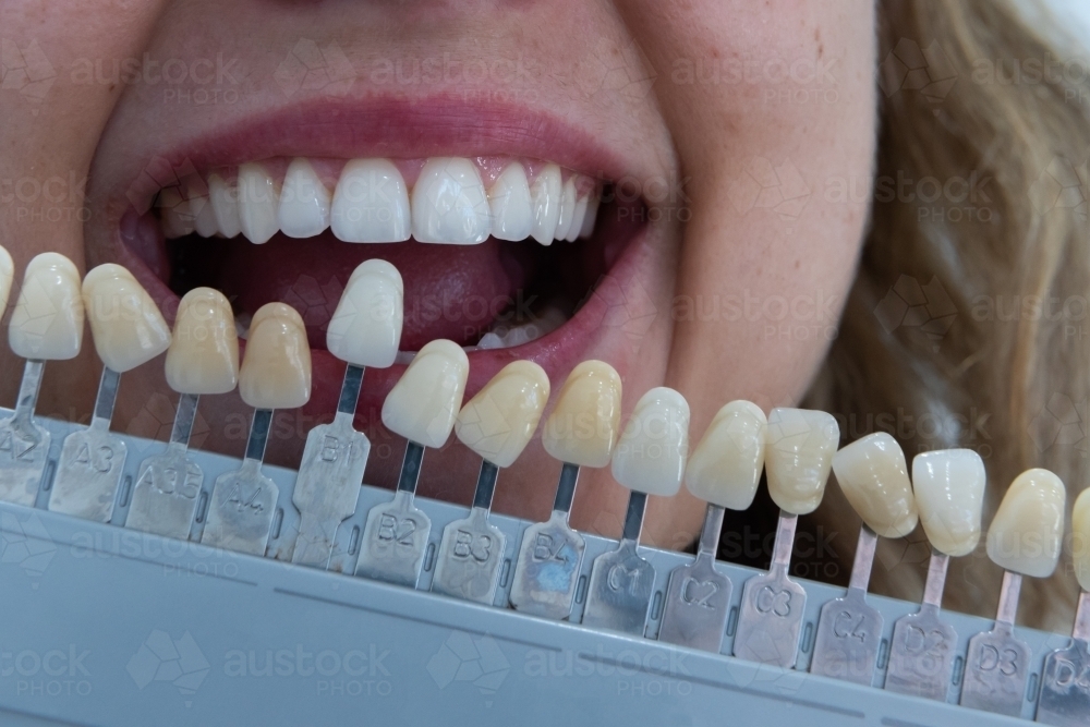 Matching teeth colour with tooth shade guide - Australian Stock Image