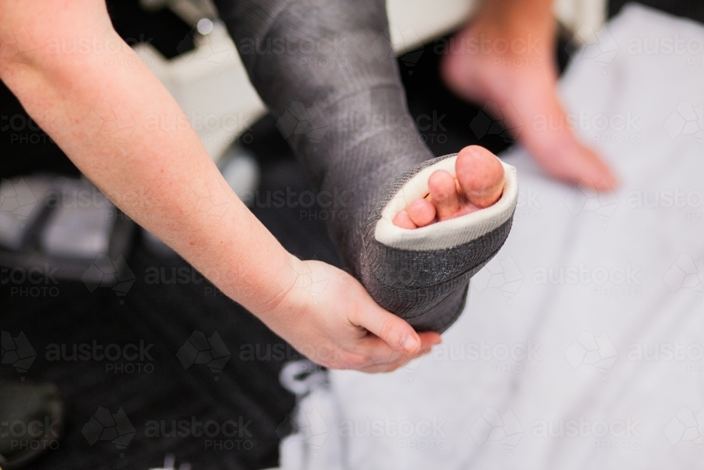 medical professional putting walking cast on leg - Australian Stock Image
