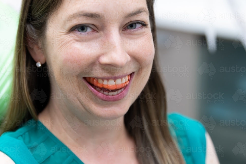Smiling woman wearing dental splint - Australian Stock Image