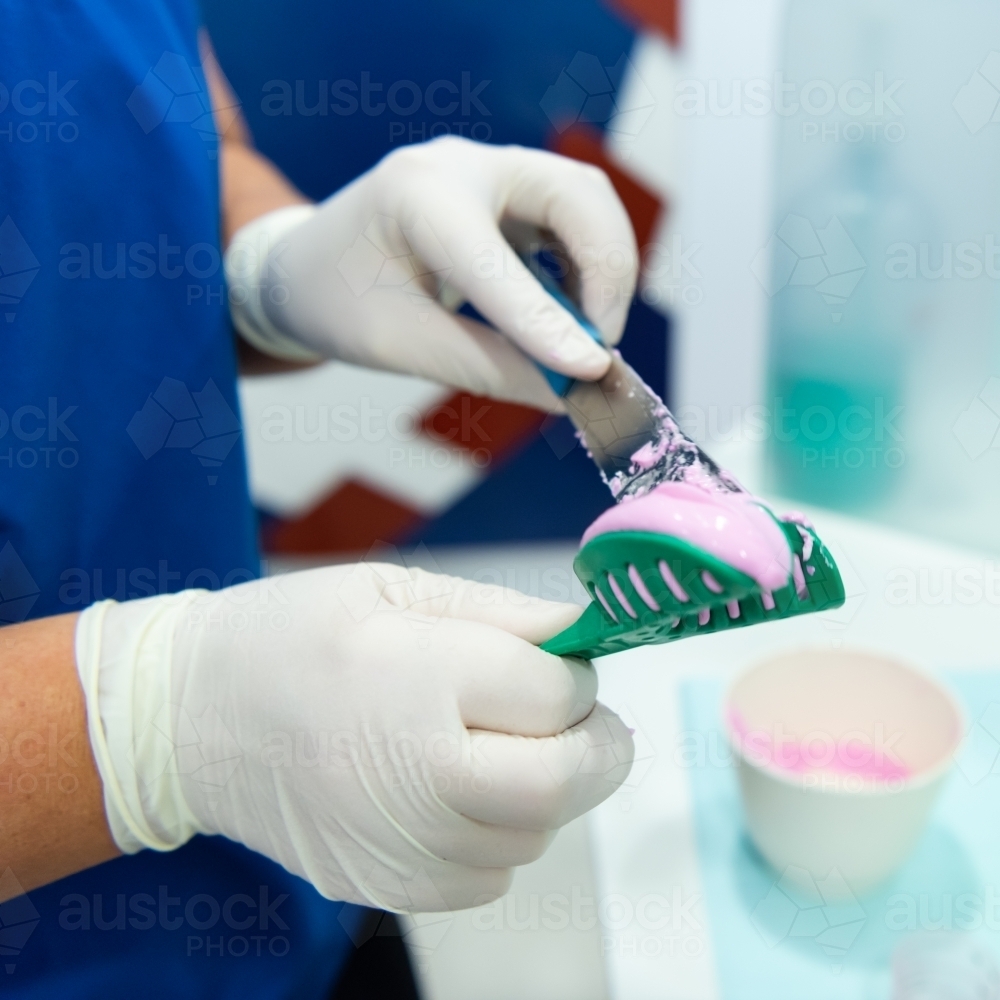 Taking dental teeth impression - Australian Stock Image