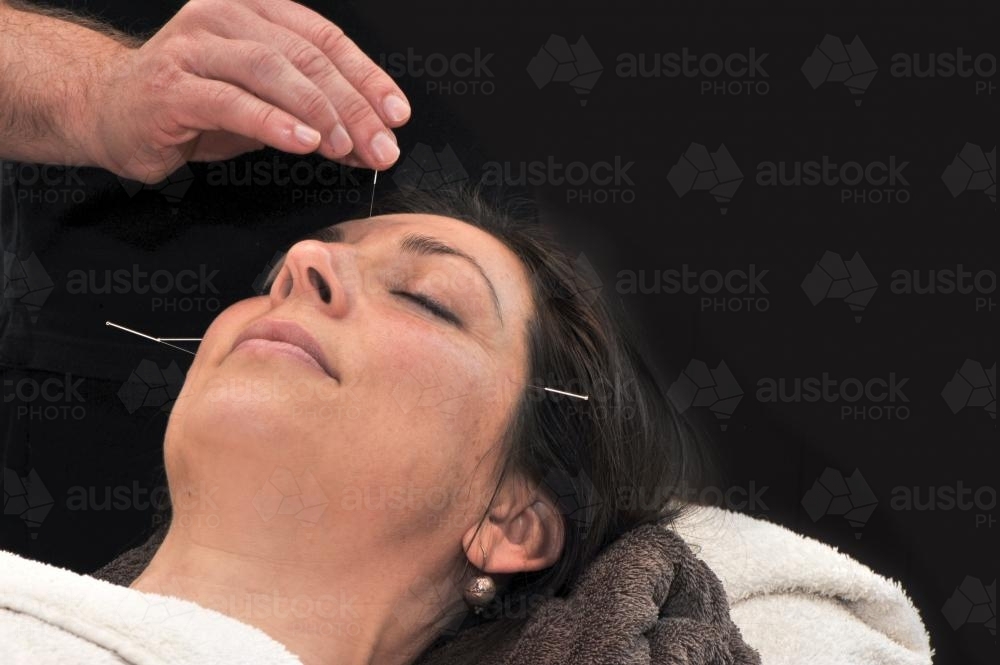 woman relaxing during acupuncture session, against a dark background - Australian Stock Image