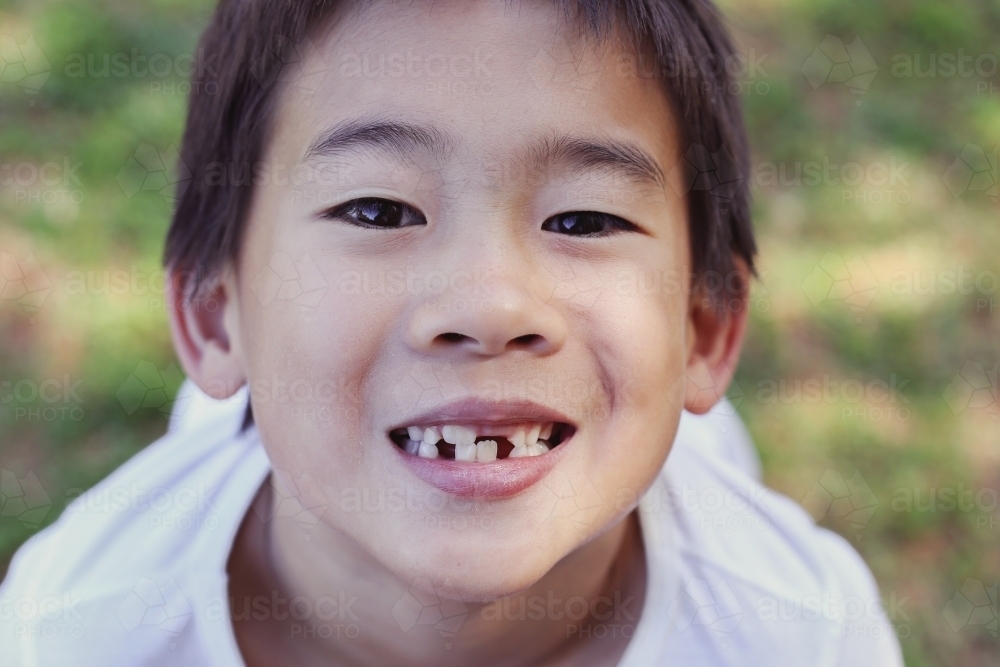 Young boy lost front teeth - Australian Stock Image