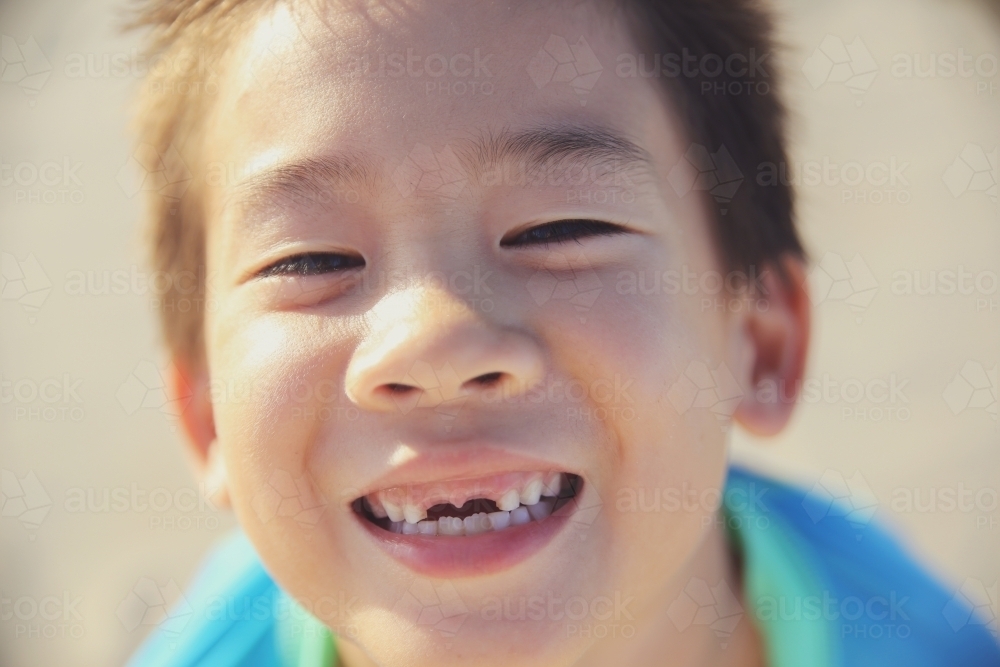 Young boy lost front teeth - Australian Stock Image