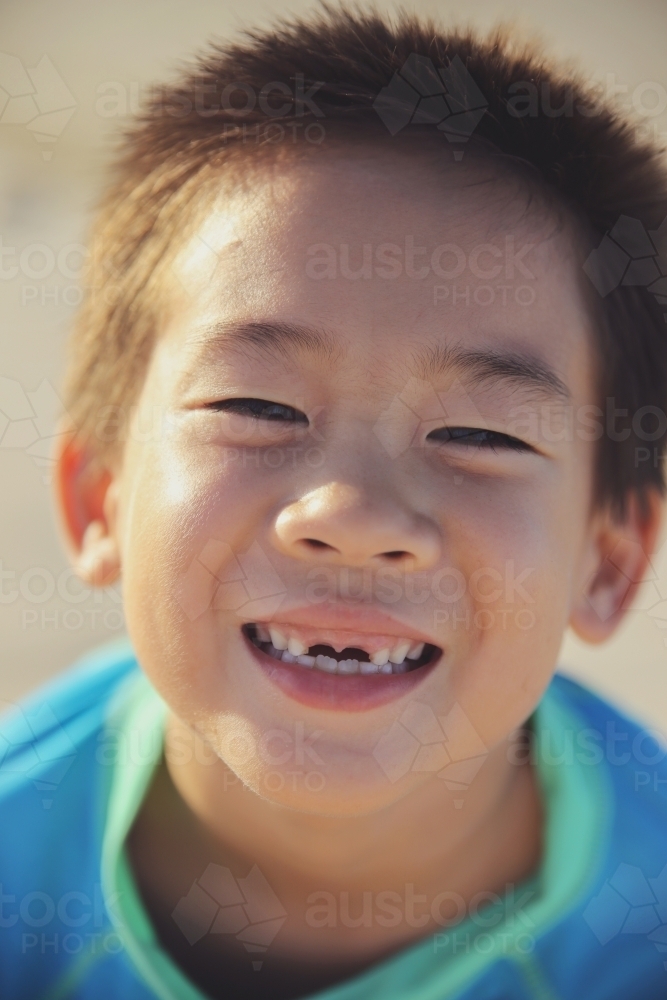 Young boy lost front teeth - Australian Stock Image