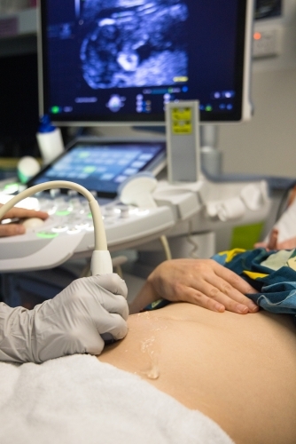 A female having an ultrasound performed on her abdomen - Australian Stock Image