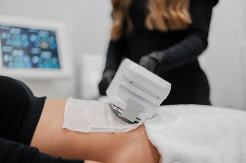 Aesthetic practitioner performing a non‑invasive body treatment on clients abdomen - Australian Stock Image