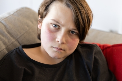 An unwell preteen boy lying on a couch looking at the camera, his cheeks are red from a fever - Australian Stock Image