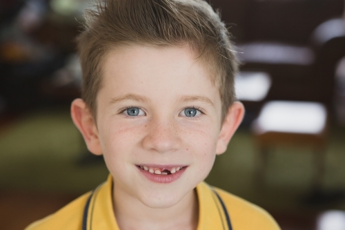 Boy smiling at camera with missing tooth