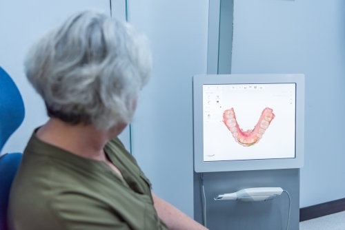 Women looking at monitor showing 3D pictures of teeth at dentist clinic